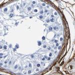 DPEP1 Antibody in Immunohistochemistry (IHC)