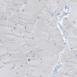 PLD3 Antibody in Immunohistochemistry (IHC)