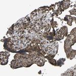 C1GALT1 Antibody in Immunohistochemistry (Paraffin) (IHC (P))