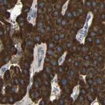 C1GALT1 Antibody in Immunohistochemistry (IHC)