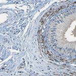 ZMAT1 Antibody in Immunohistochemistry (IHC)