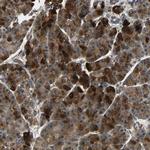 ATP7A Antibody in Immunohistochemistry (Paraffin) (IHC (P))