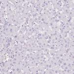 Cathepsin E Antibody in Immunohistochemistry (Paraffin) (IHC (P))