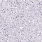 Cathepsin E Antibody in Immunohistochemistry (IHC)