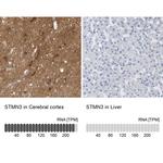 STMN3 Antibody in Immunohistochemistry (IHC)