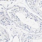 STMN3 Antibody in Immunohistochemistry (IHC)