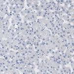 STMN3 Antibody in Immunohistochemistry (IHC)