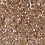 STMN3 Antibody in Immunohistochemistry (IHC)