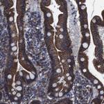 SPTBN1 Antibody in Immunohistochemistry (IHC)