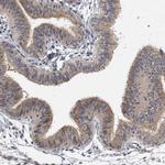 IL11RA Antibody in Immunohistochemistry (Paraffin) (IHC (P))