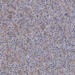 IL11RA Antibody in Immunohistochemistry (Paraffin) (IHC (P))