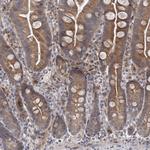 IL11RA Antibody in Immunohistochemistry (Paraffin) (IHC (P))