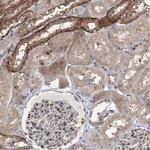 IL11RA Antibody in Immunohistochemistry (IHC)