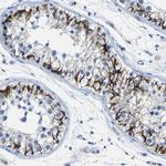 Claudin 11 Antibody in Immunohistochemistry (IHC)