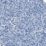 Claudin 11 Antibody in Immunohistochemistry (IHC)