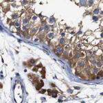 CLCC1 Antibody in Immunohistochemistry (IHC)