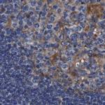 CLCC1 Antibody in Immunohistochemistry (IHC)