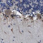 CLCC1 Antibody in Immunohistochemistry (IHC)