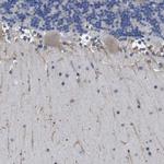 CLCC1 Antibody in Immunohistochemistry (IHC)