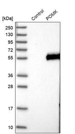 POMK Antibody in Western Blot (WB)