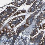 WSCD2 Antibody in Immunohistochemistry (Paraffin) (IHC (P))