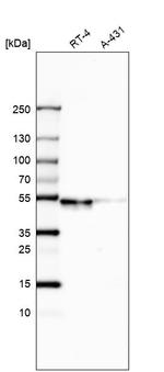 WSCD2 Antibody in Western Blot (WB)