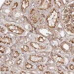 PTPN22 Antibody in Immunohistochemistry (Paraffin) (IHC (P))