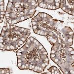 PTPN22 Antibody in Immunohistochemistry (Paraffin) (IHC (P))