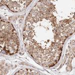 PTPN22 Antibody in Immunohistochemistry (Paraffin) (IHC (P))