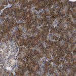 DDRGK1 Antibody in Immunohistochemistry (Paraffin) (IHC (P))