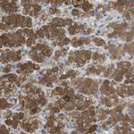 DDRGK1 Antibody in Immunohistochemistry (IHC)