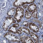 SNX19 Antibody in Immunohistochemistry (Paraffin) (IHC (P))