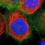 MYO1B Antibody in Immunocytochemistry (ICC/IF)