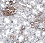 MYO1B Antibody in Immunohistochemistry (IHC)