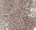 MYO1B Antibody in Immunohistochemistry (IHC)