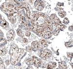 MYO1B Antibody in Immunohistochemistry (IHC)