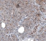 MYO1B Antibody in Immunohistochemistry (IHC)