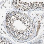 MAGI2 Antibody in Immunohistochemistry (IHC)