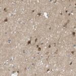 MAGI2 Antibody in Immunohistochemistry (IHC)