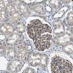 MAGI2 Antibody in Immunohistochemistry (IHC)