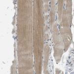 MAGI2 Antibody in Immunohistochemistry (IHC)