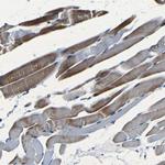 NCMAP Antibody in Immunohistochemistry (Paraffin) (IHC (P))