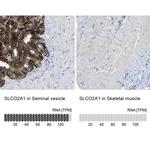 SLCO2A1 Antibody