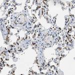 SLCO2A1 Antibody in Immunohistochemistry (IHC)