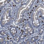 ALOX15 Antibody in Immunohistochemistry (Paraffin) (IHC (P))