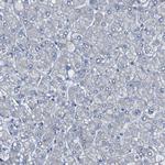 ALOX15 Antibody in Immunohistochemistry (Paraffin) (IHC (P))