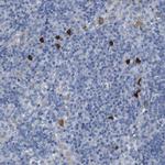 ALOX15 Antibody in Immunohistochemistry (Paraffin) (IHC (P))