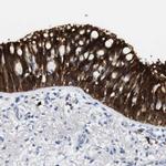 ALOX15 Antibody in Immunohistochemistry (IHC)