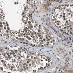 ZBTB46 Antibody in Immunohistochemistry (Paraffin) (IHC (P))