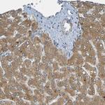 CYP4F2 Antibody in Immunohistochemistry (Paraffin) (IHC (P))